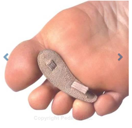 Hammer Toe Crests