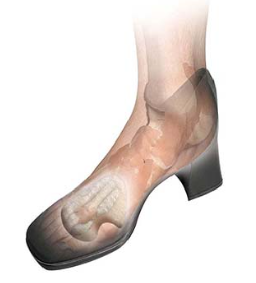 Dancer Pads